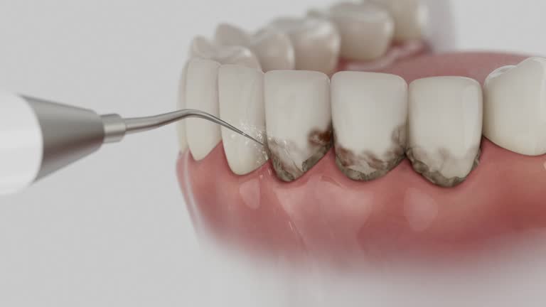 Trusted Dental Implants service in Broadway, NC - Dentist Open Now